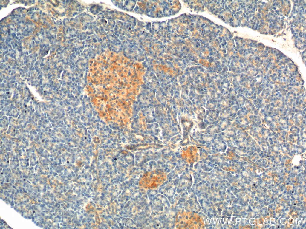 Immunohistochemistry (IHC) staining of human pancreas tissue using UBR1 Polyclonal antibody (26069-1-AP)