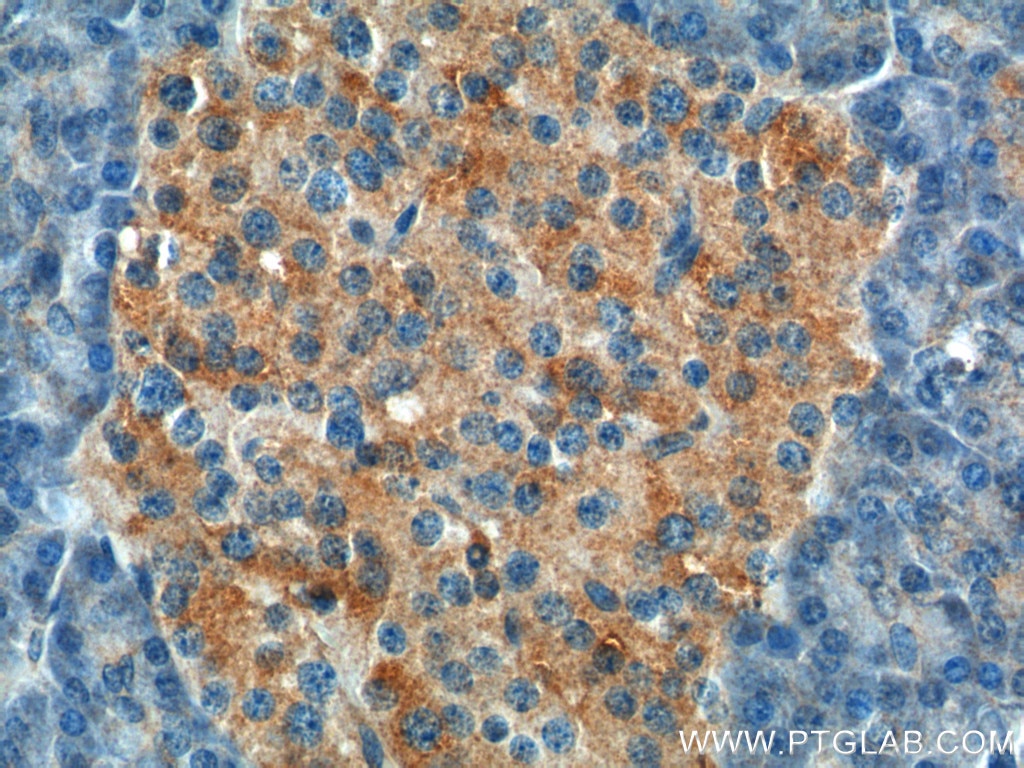 Immunohistochemistry (IHC) staining of human pancreas tissue using UBR1 Polyclonal antibody (26069-1-AP)