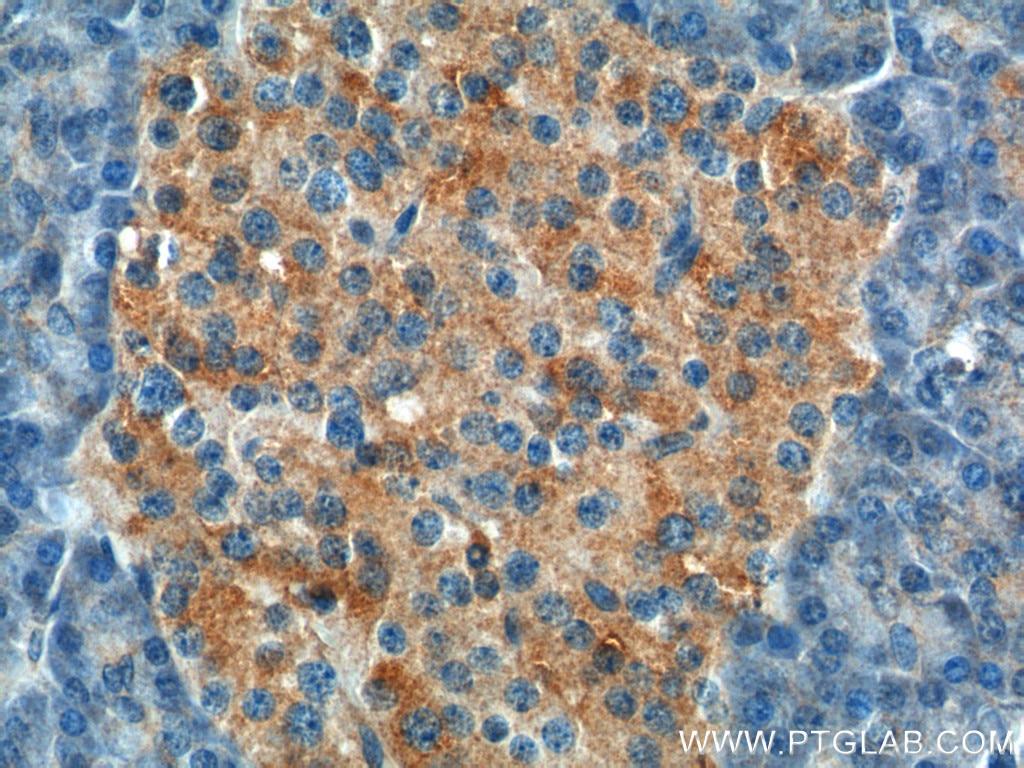 Immunohistochemistry (IHC) staining of human pancreas tissue using UBR1 Polyclonal antibody (26069-1-AP)