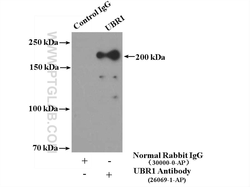 Immunoprecipitation (IP) experiment of mouse skeletal muscle tissue using UBR1 Polyclonal antibody (26069-1-AP)