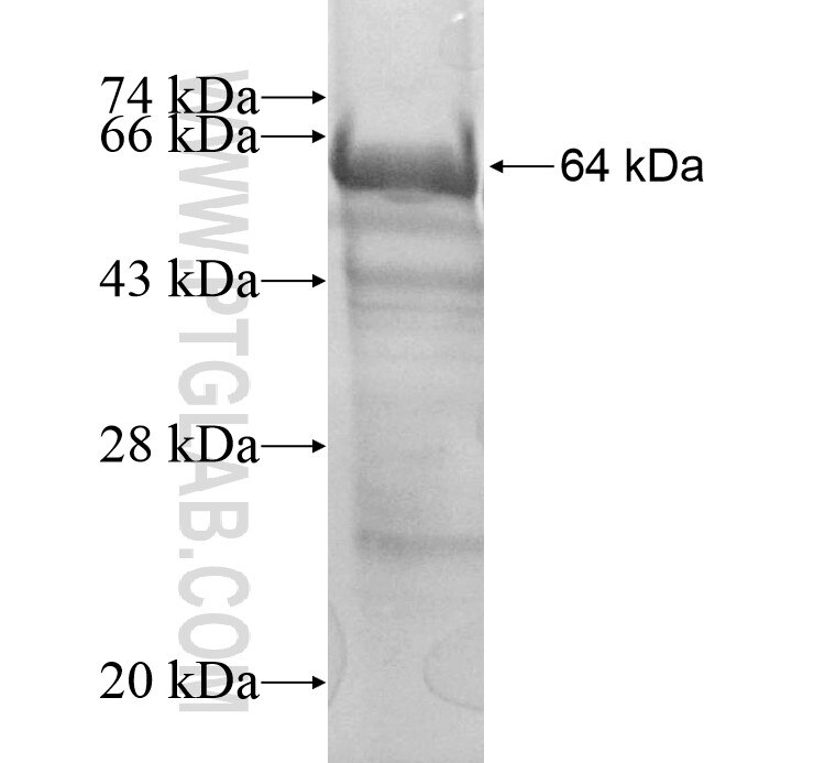 UBR1 fusion protein Ag13589 SDS-PAGE