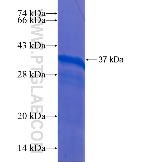 UBR1 fusion protein Ag22076 SDS-PAGE