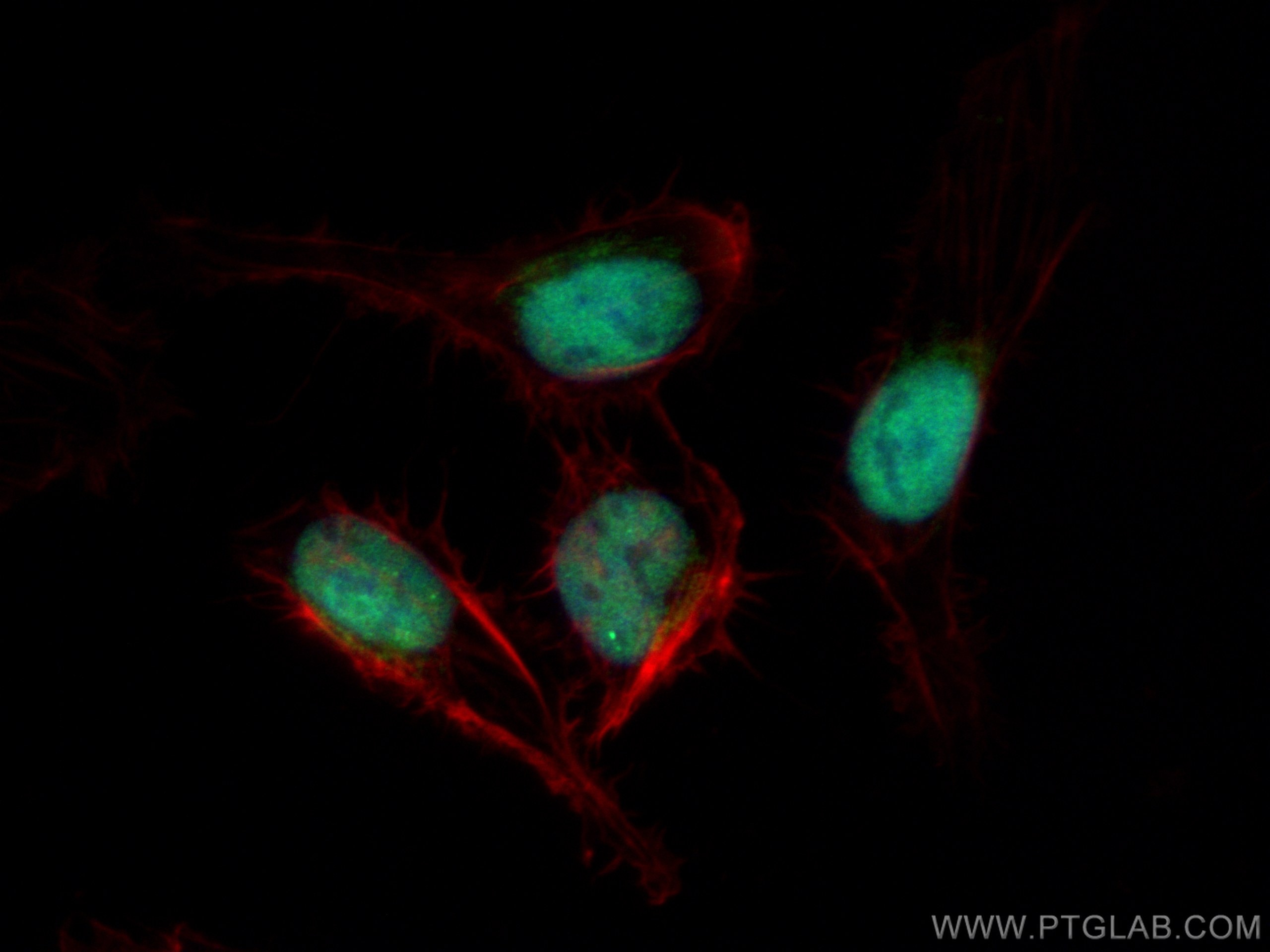Immunofluorescence (IF) / fluorescent staining of U2OS cells using UBR2 Polyclonal antibody (18853-1-AP)
