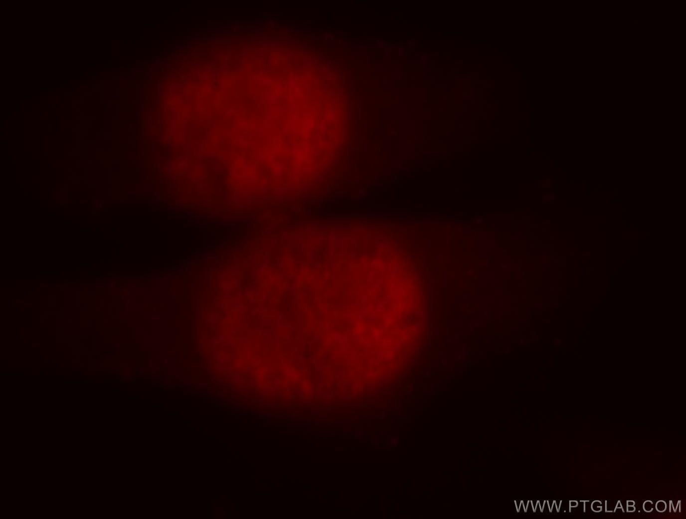 Immunofluorescence (IF) / fluorescent staining of HepG2 cells using UBR2 Polyclonal antibody (18853-1-AP)