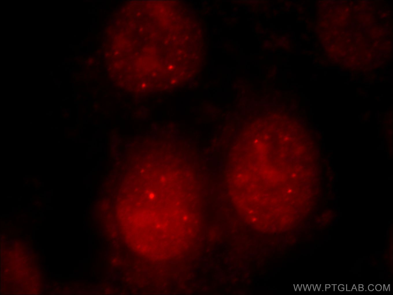 Immunofluorescence (IF) / fluorescent staining of HepG2 cells using UBR2 Polyclonal antibody (18853-1-AP)