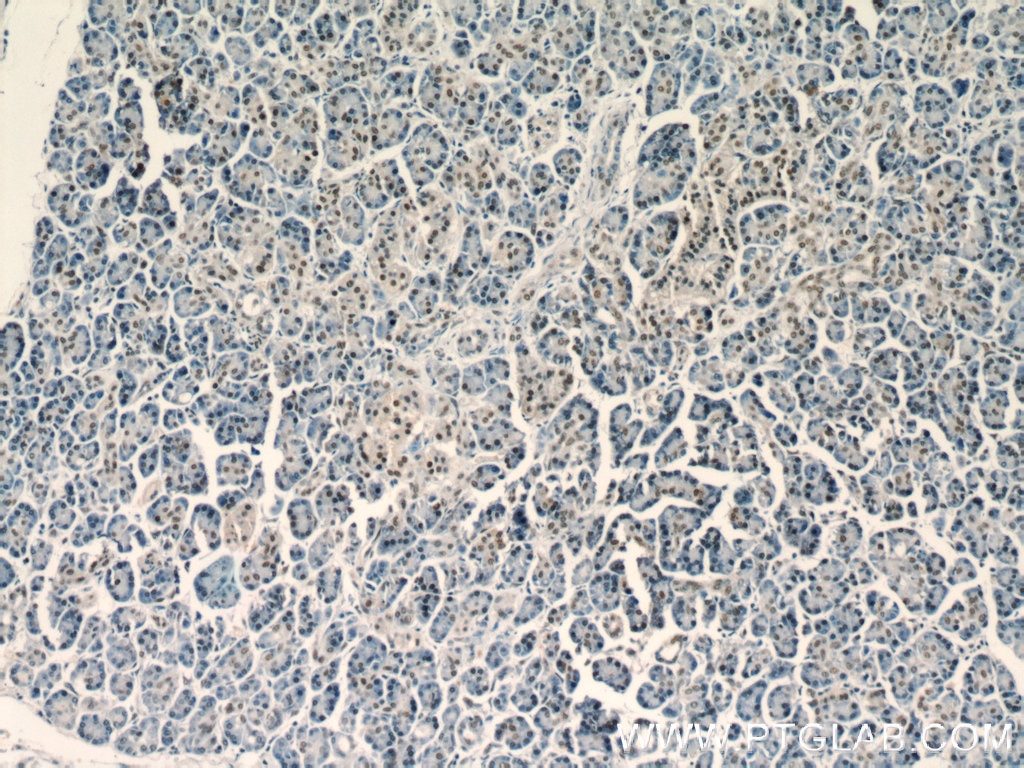 Immunohistochemistry (IHC) staining of human pancreas tissue using UBR2 Polyclonal antibody (18853-1-AP)