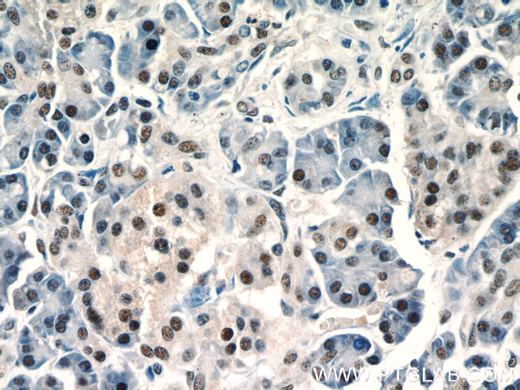 Immunohistochemistry (IHC) staining of human pancreas tissue using UBR2 Polyclonal antibody (18853-1-AP)