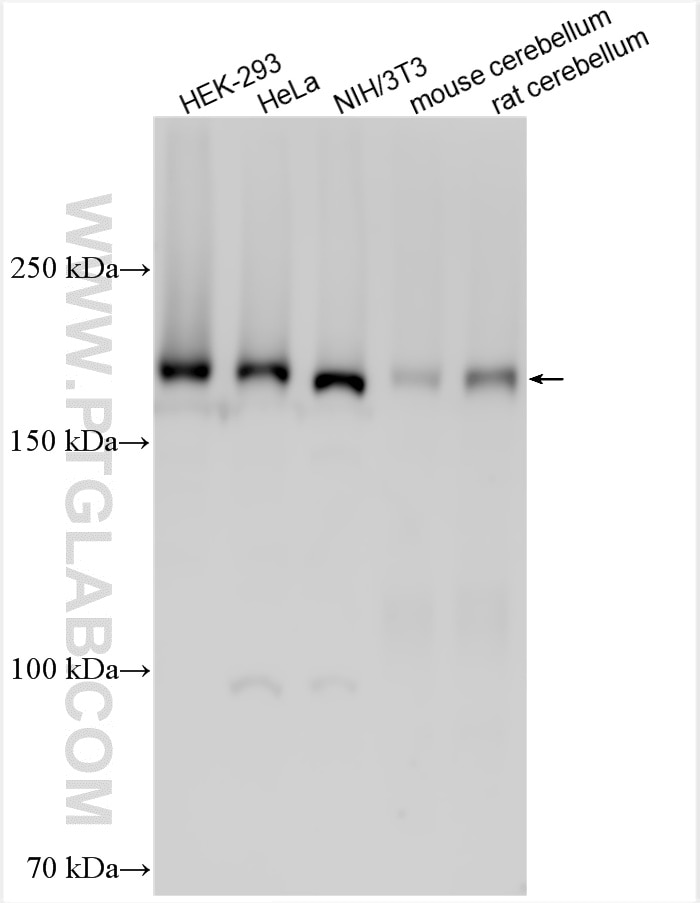 WB analysis using 18853-1-AP Western Blot (WB) analysis of various lysates using UBR2 Polyclonal antibody (18853-1-AP)