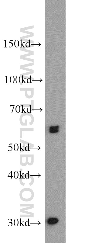 Western Blot (WB) analysis of mouse heart tissue using UBR2 Polyclonal antibody (18853-1-AP)
