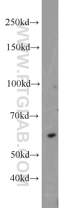 Western Blot (WB) analysis of mouse cerebellum tissue using UBR2 Polyclonal antibody (18853-1-AP)