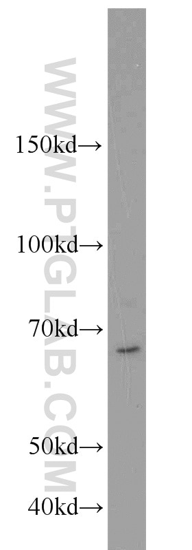 Western Blot (WB) analysis of BxPC-3 cells using UBR2 Polyclonal antibody (18853-1-AP)