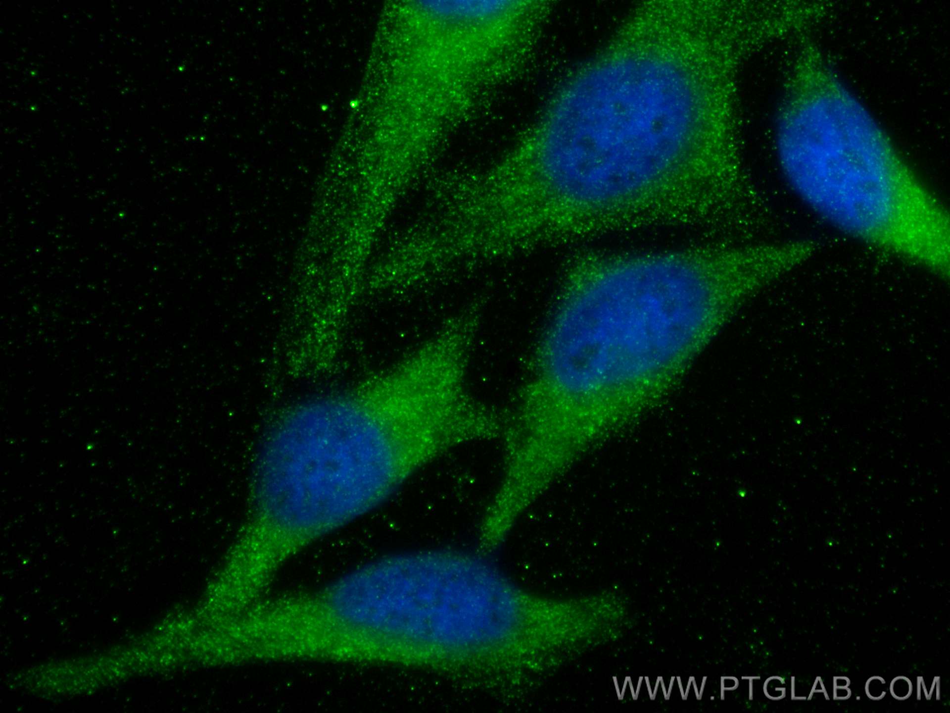 Immunofluorescence (IF) / fluorescent staining of HeLa cells using UBR4 Polyclonal antibody (15966-1-AP)