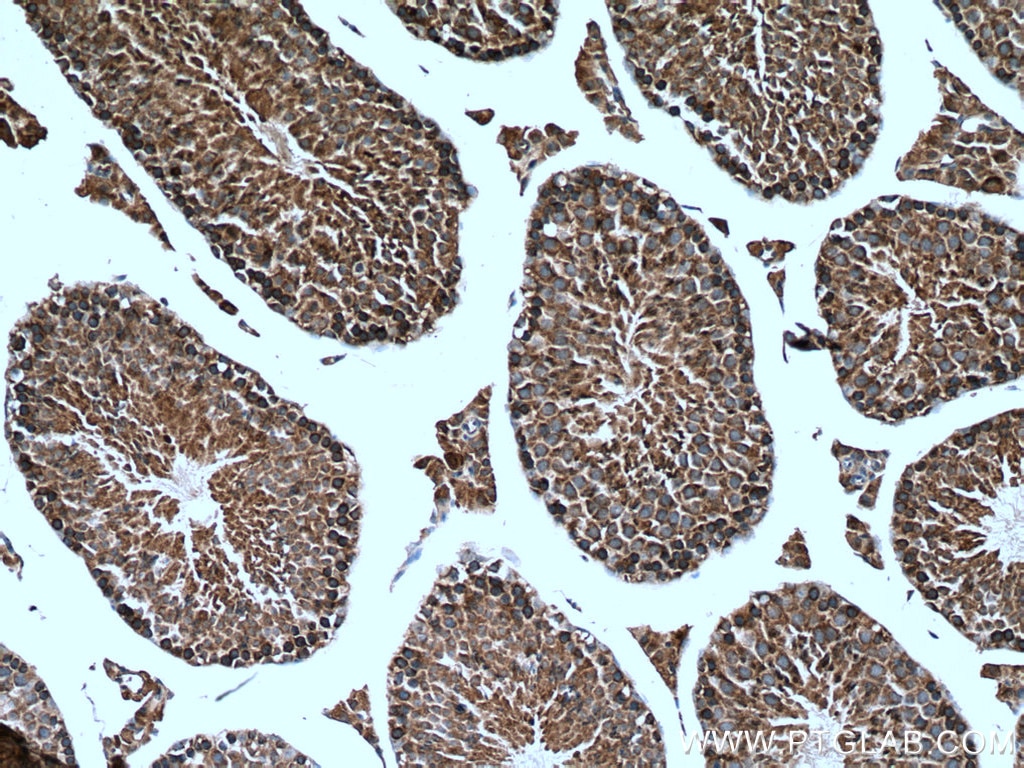 Immunohistochemistry (IHC) staining of mouse testis tissue using UBR4 Polyclonal antibody (15966-1-AP)