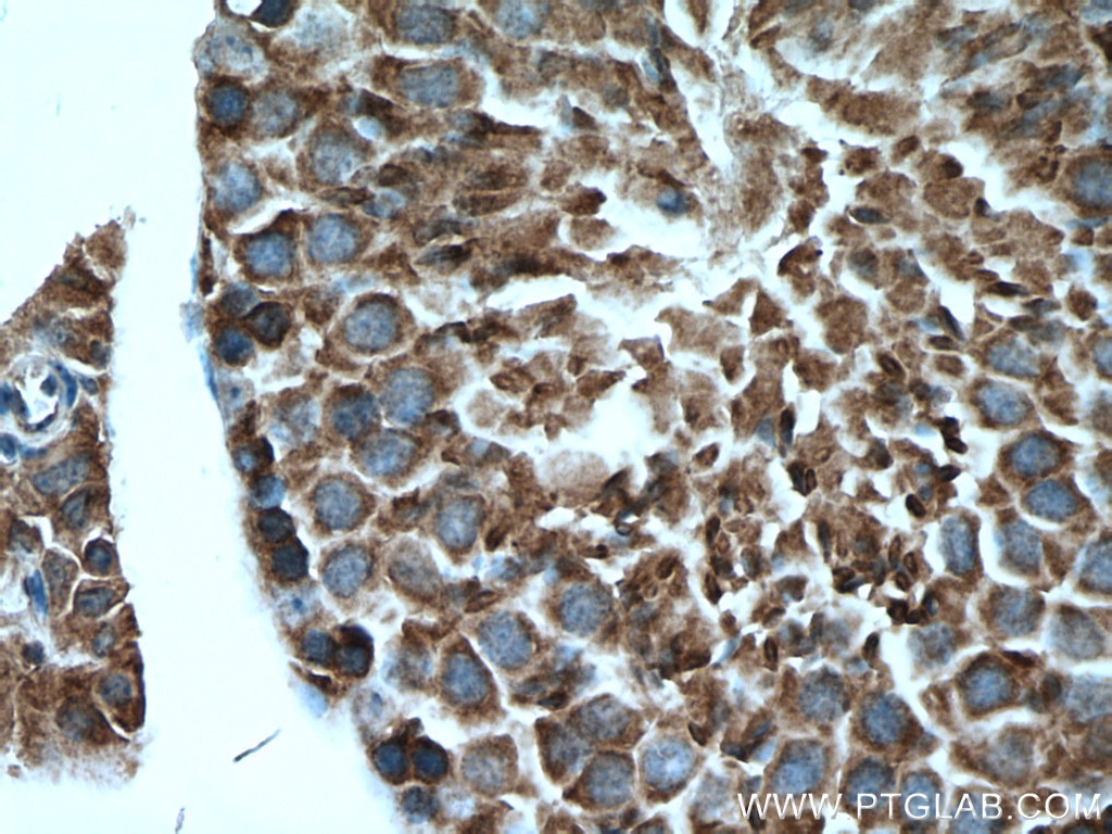 Immunohistochemistry (IHC) staining of mouse testis tissue using UBR4 Polyclonal antibody (15966-1-AP)