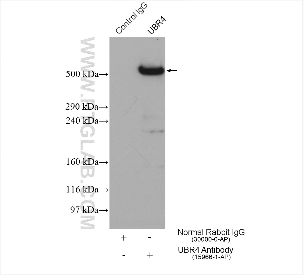 Immunoprecipitation (IP) experiment of HeLa cells using UBR4 Polyclonal antibody (15966-1-AP)