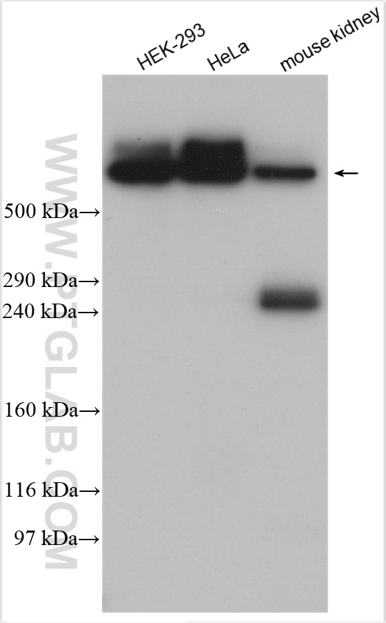 Western Blot (WB) analysis of various lysates using UBR4 Polyclonal antibody (15966-1-AP)
