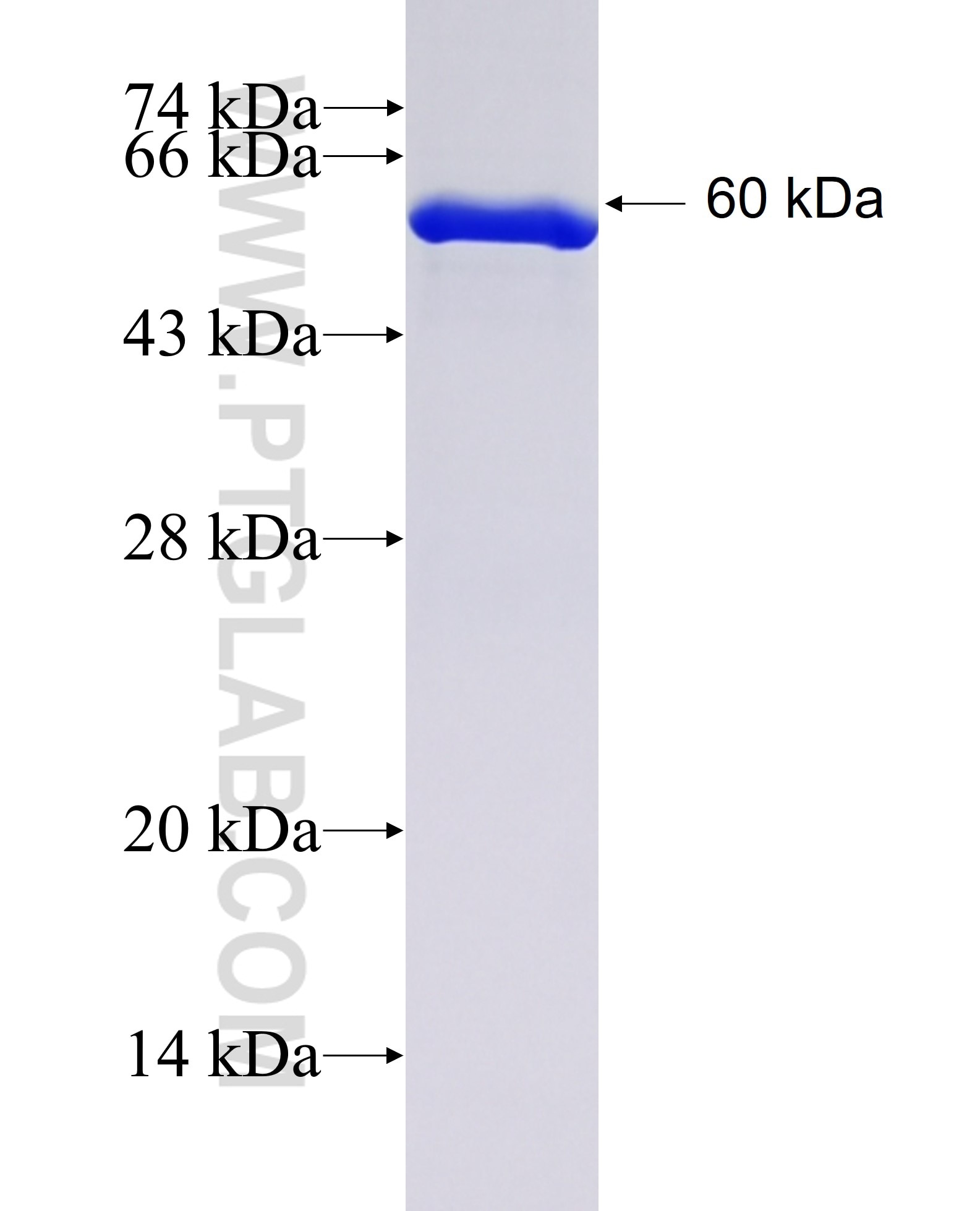 UBR4 fusion protein Ag8740 SDS-PAGE