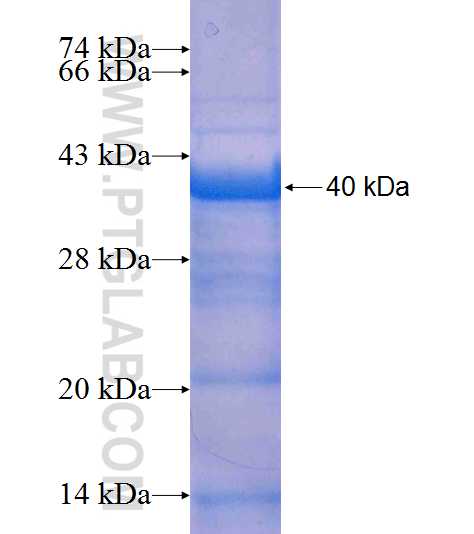 UBR4 fusion protein Ag9099 SDS-PAGE