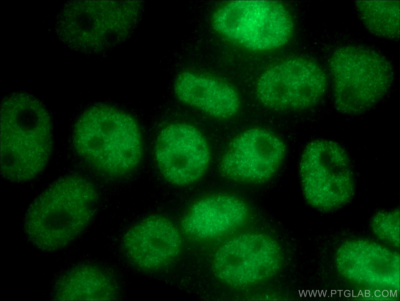 Immunofluorescence (IF) / fluorescent staining of MCF-7 cells using UBR5 Polyclonal antibody (22782-1-AP)