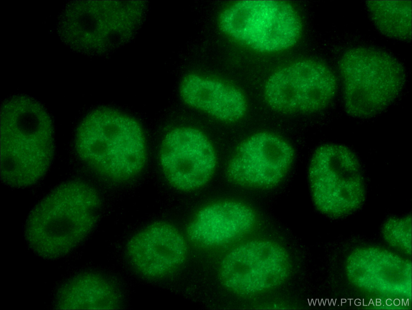 IF Staining of MCF-7 using 22782-1-AP