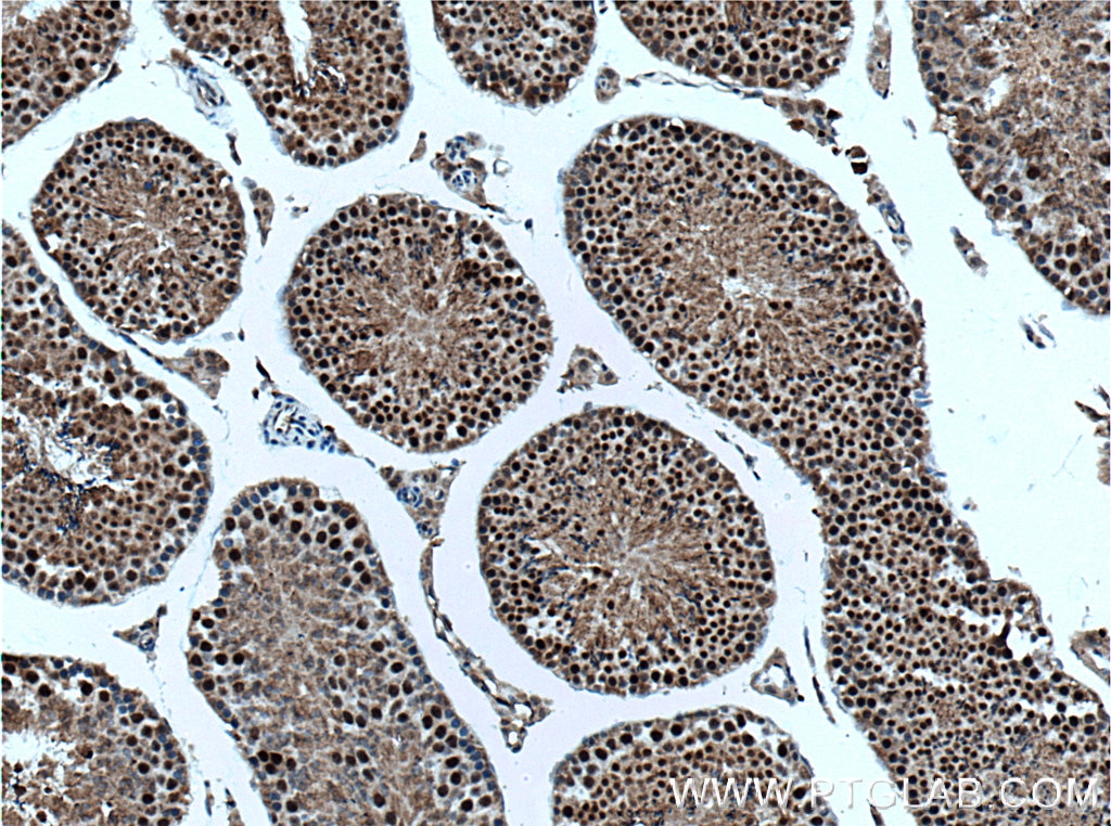 IHC staining of mouse testis using 22782-1-AP