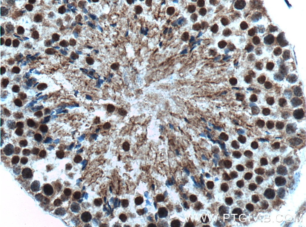 Immunohistochemistry (IHC) staining of mouse testis tissue using UBR5 Polyclonal antibody (22782-1-AP)