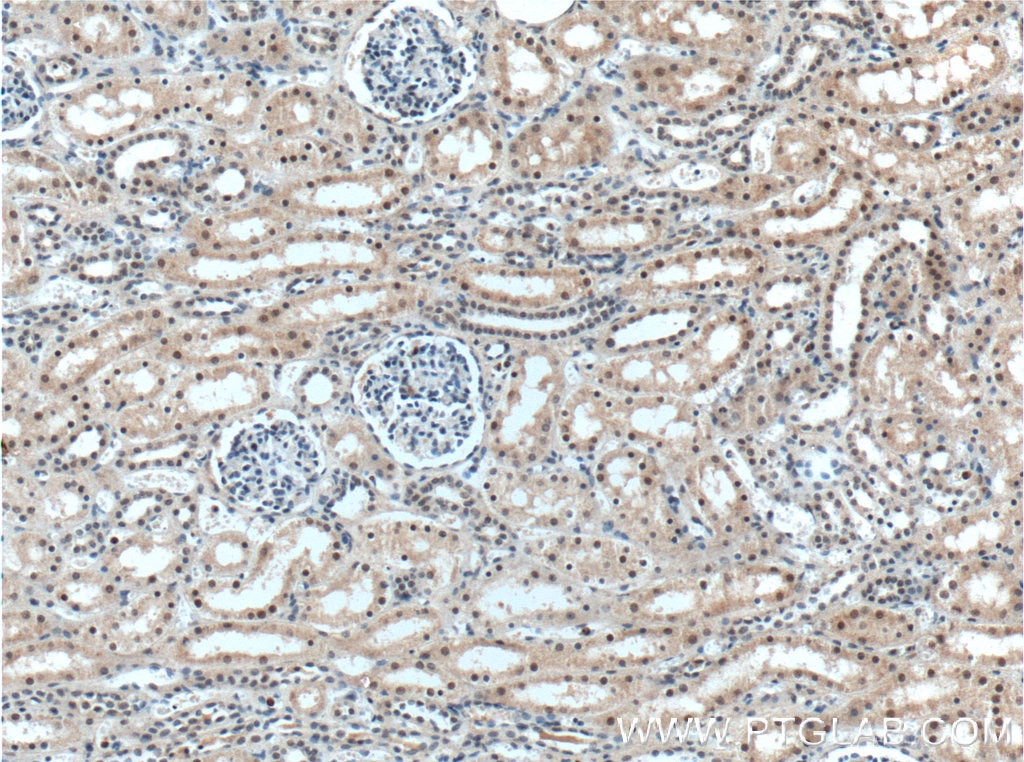 Immunohistochemistry (IHC) staining of human kidney tissue using UBR5 Polyclonal antibody (22782-1-AP)