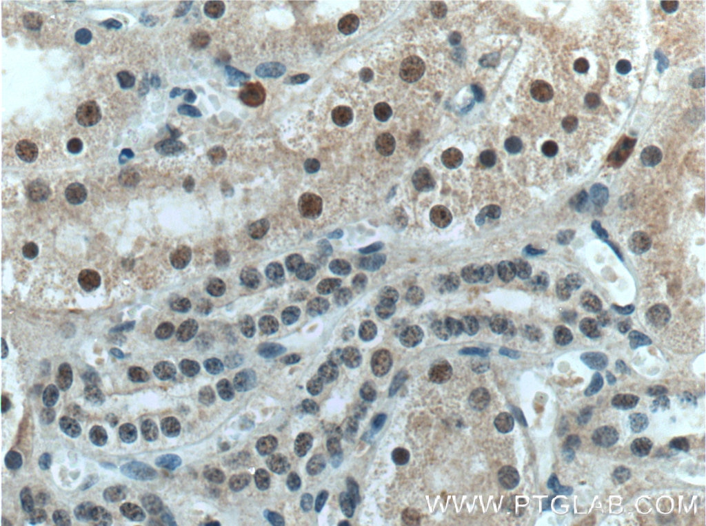 Immunohistochemistry (IHC) staining of human kidney tissue using UBR5 Polyclonal antibody (22782-1-AP)