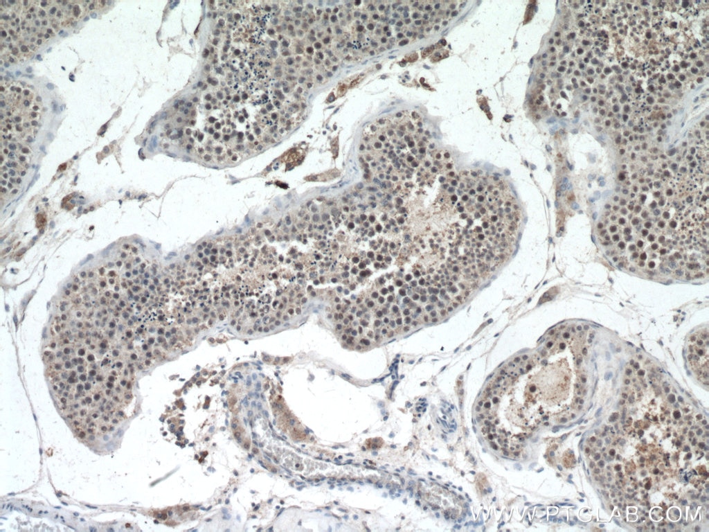 Immunohistochemistry (IHC) staining of human testis tissue using UBR5 Polyclonal antibody (22782-1-AP)