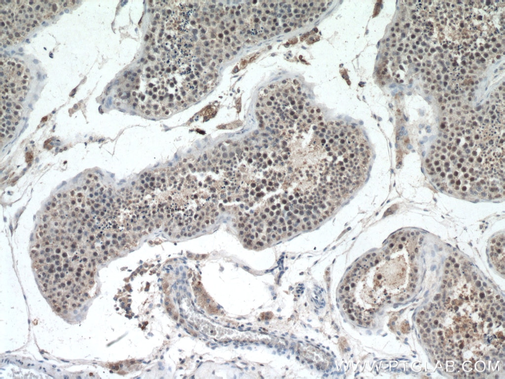 IHC staining of human testis using 22782-1-AP