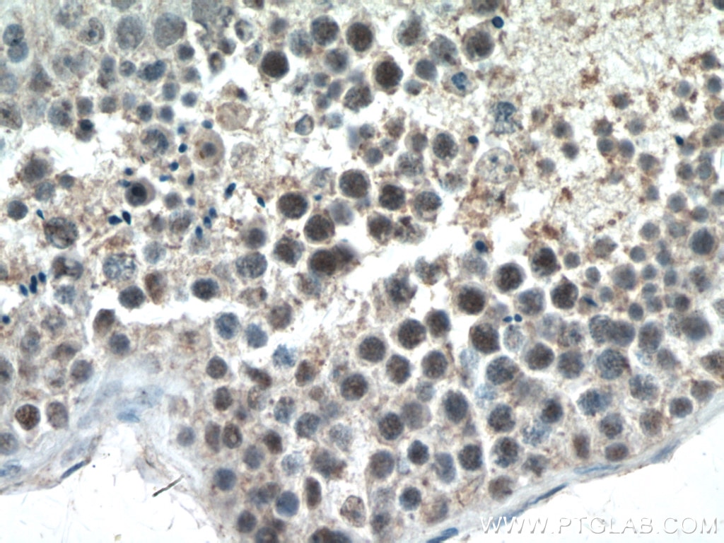 Immunohistochemistry (IHC) staining of human testis tissue using UBR5 Polyclonal antibody (22782-1-AP)