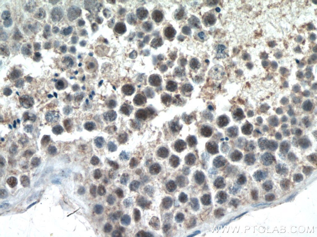 IHC staining of human testis using 22782-1-AP