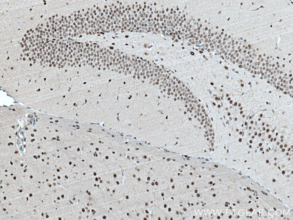 IHC staining of mouse brain using 66937-1-Ig