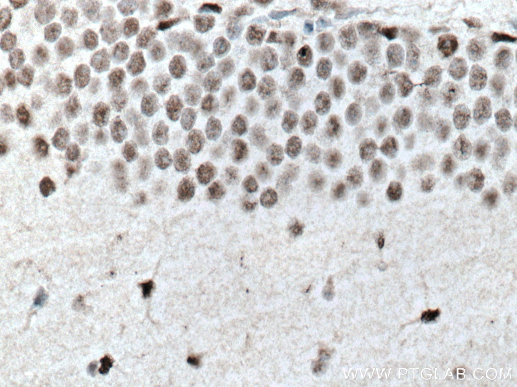Immunohistochemistry (IHC) staining of mouse brain tissue using UBR5 Monoclonal antibody (66937-1-Ig)