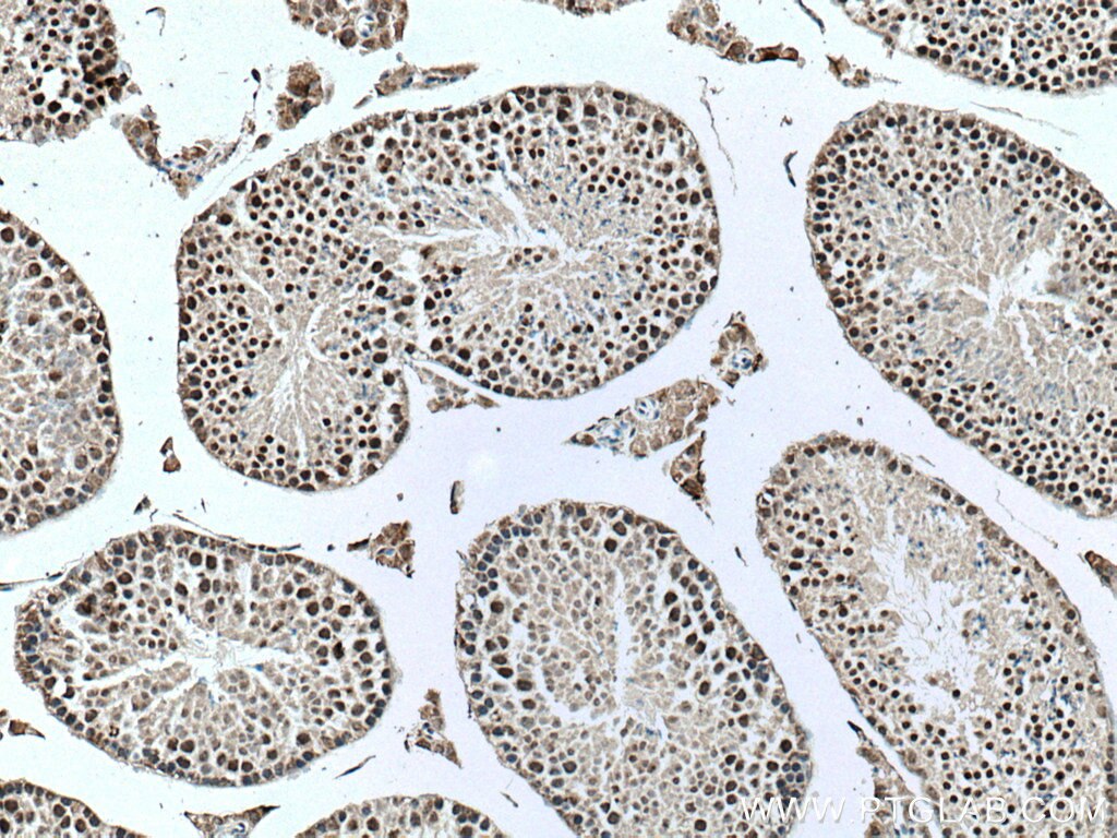Immunohistochemistry (IHC) staining of mouse testis tissue using UBR5 Monoclonal antibody (66937-1-Ig)