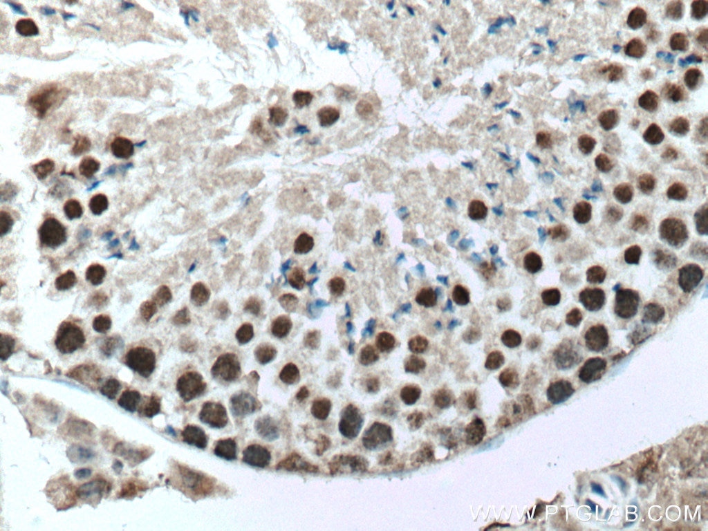 IHC staining of mouse testis using 66937-1-Ig