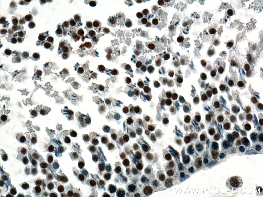 Immunohistochemistry (IHC) staining of rat testis tissue using UBR5 Monoclonal antibody (66937-1-Ig)