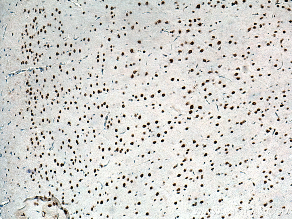 Immunohistochemistry (IHC) staining of rat brain tissue using UBR5 Monoclonal antibody (66937-1-Ig)