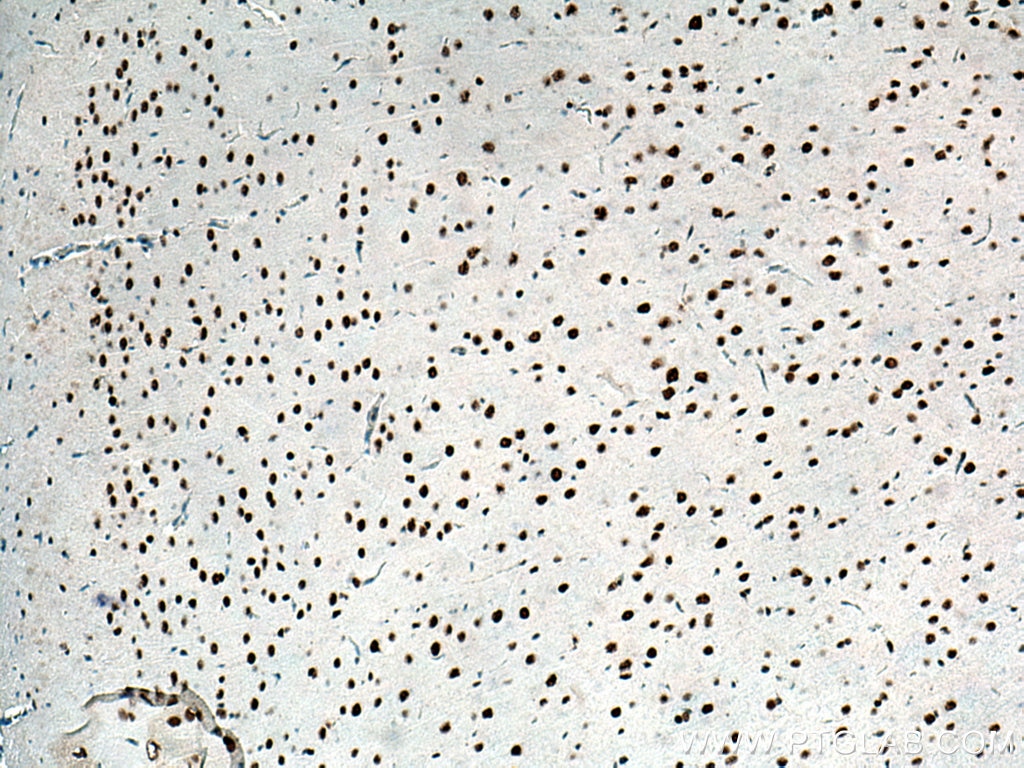 IHC staining of rat brain using 66937-1-Ig