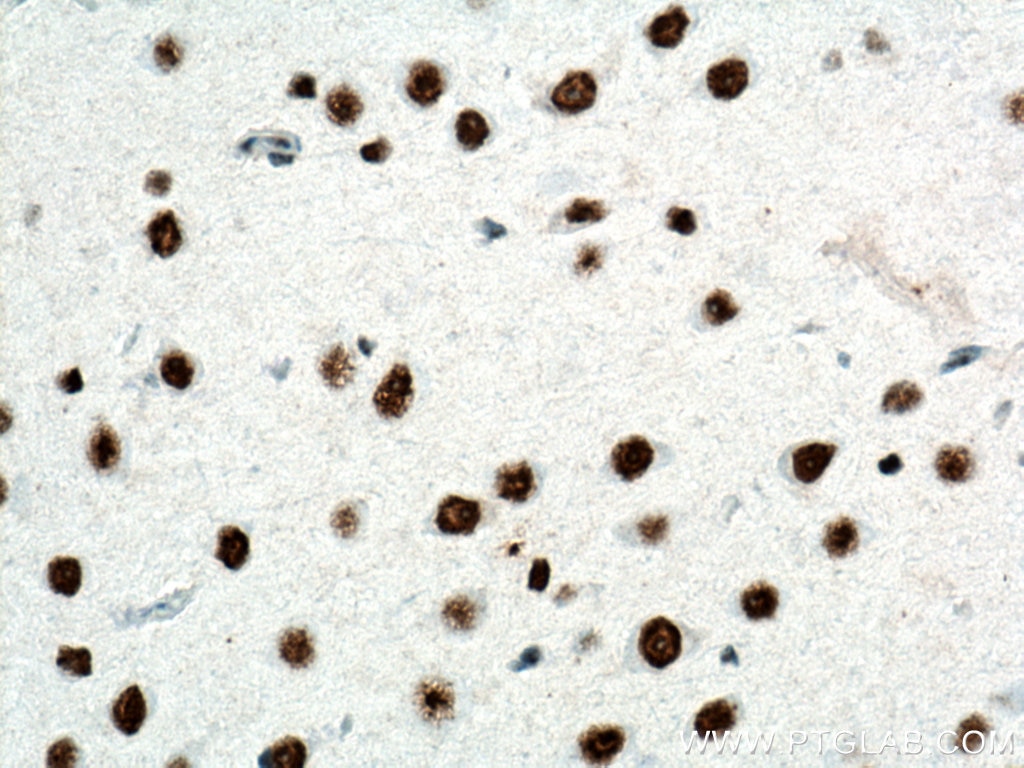 IHC staining of rat brain using 66937-1-Ig