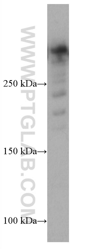Western Blot (WB) analysis of PC-12 cells using UBR5 Monoclonal antibody (66937-1-Ig)