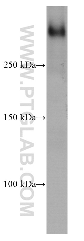 Western Blot (WB) analysis of HeLa cells using UBR5 Monoclonal antibody (66937-1-Ig)