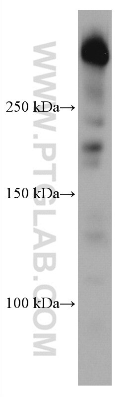 Western Blot (WB) analysis of Jurkat cells using UBR5 Monoclonal antibody (66937-1-Ig)