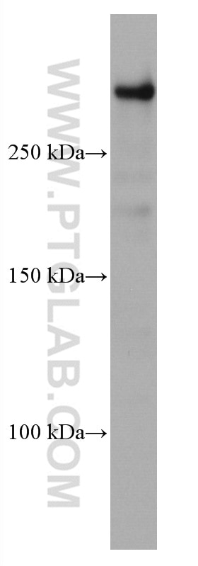Western Blot (WB) analysis of Neuro-2a cells using UBR5 Monoclonal antibody (66937-1-Ig)