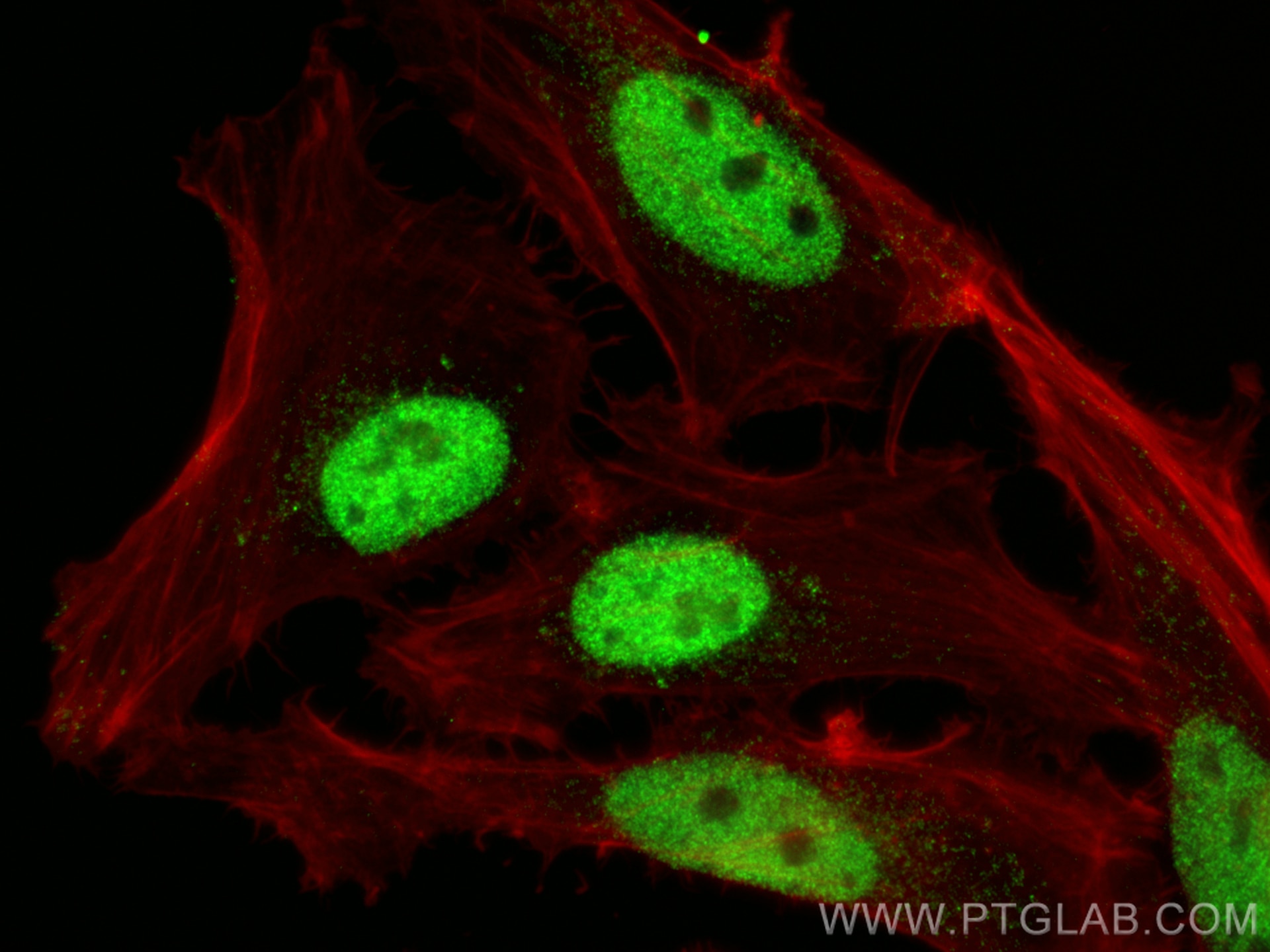 Immunofluorescence (IF) / fluorescent staining of HeLa cells using UBR7 Polyclonal antibody (16903-1-AP)