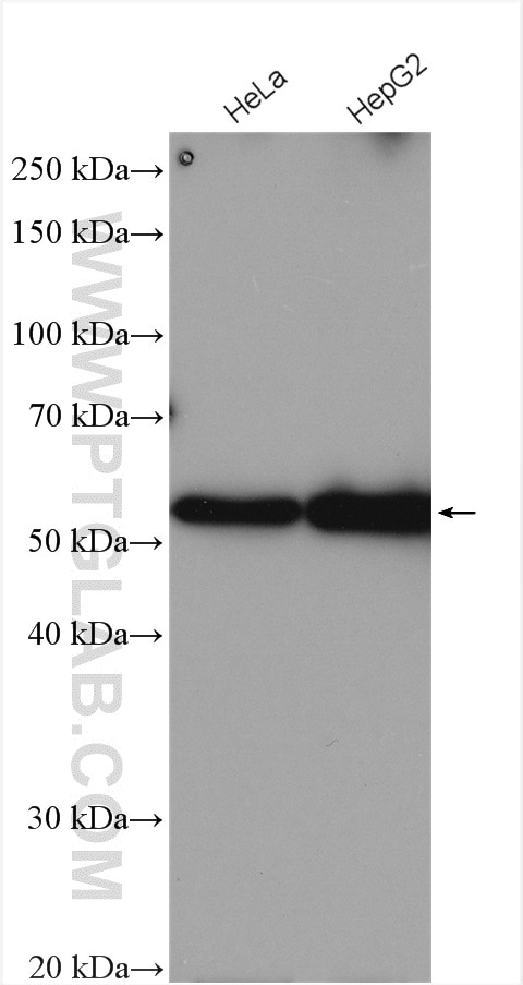 Western Blot (WB) analysis of various lysates using UBR7 Polyclonal antibody (16903-1-AP)