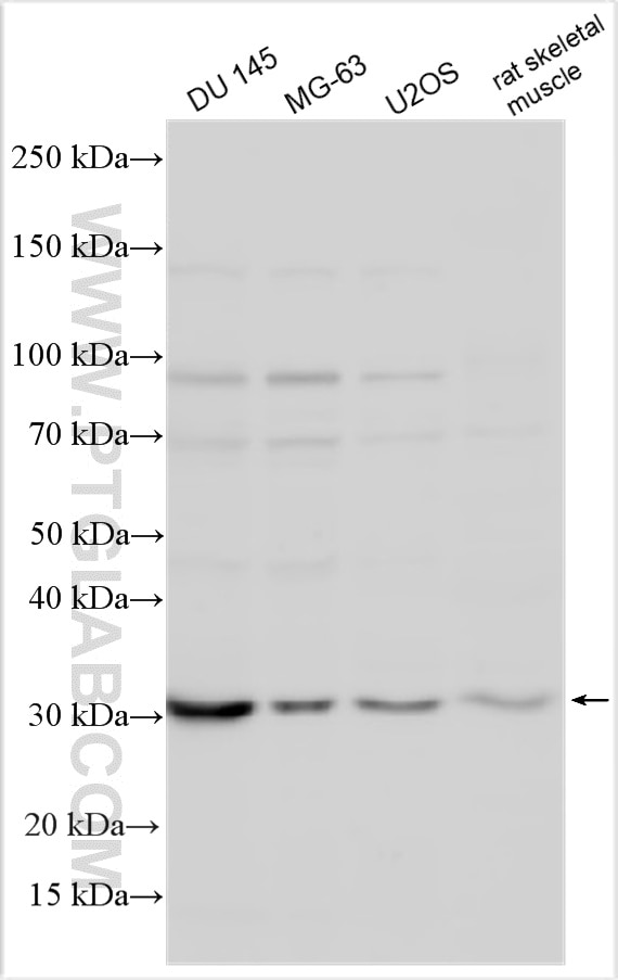Western Blot (WB) analysis of various lysates using UBTD1 Polyclonal antibody (20158-1-AP)