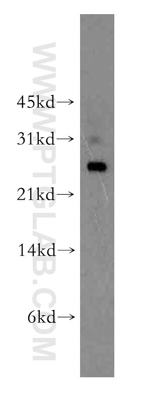 Western Blot (WB) analysis of human liver tissue using UBTD2 Polyclonal antibody (13172-1-AP)