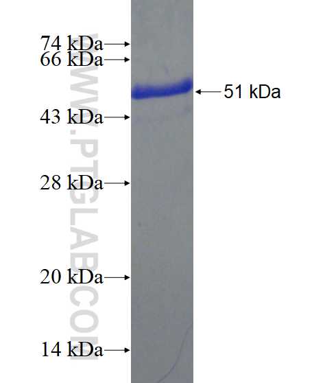 UBTD2 fusion protein Ag3827 SDS-PAGE
