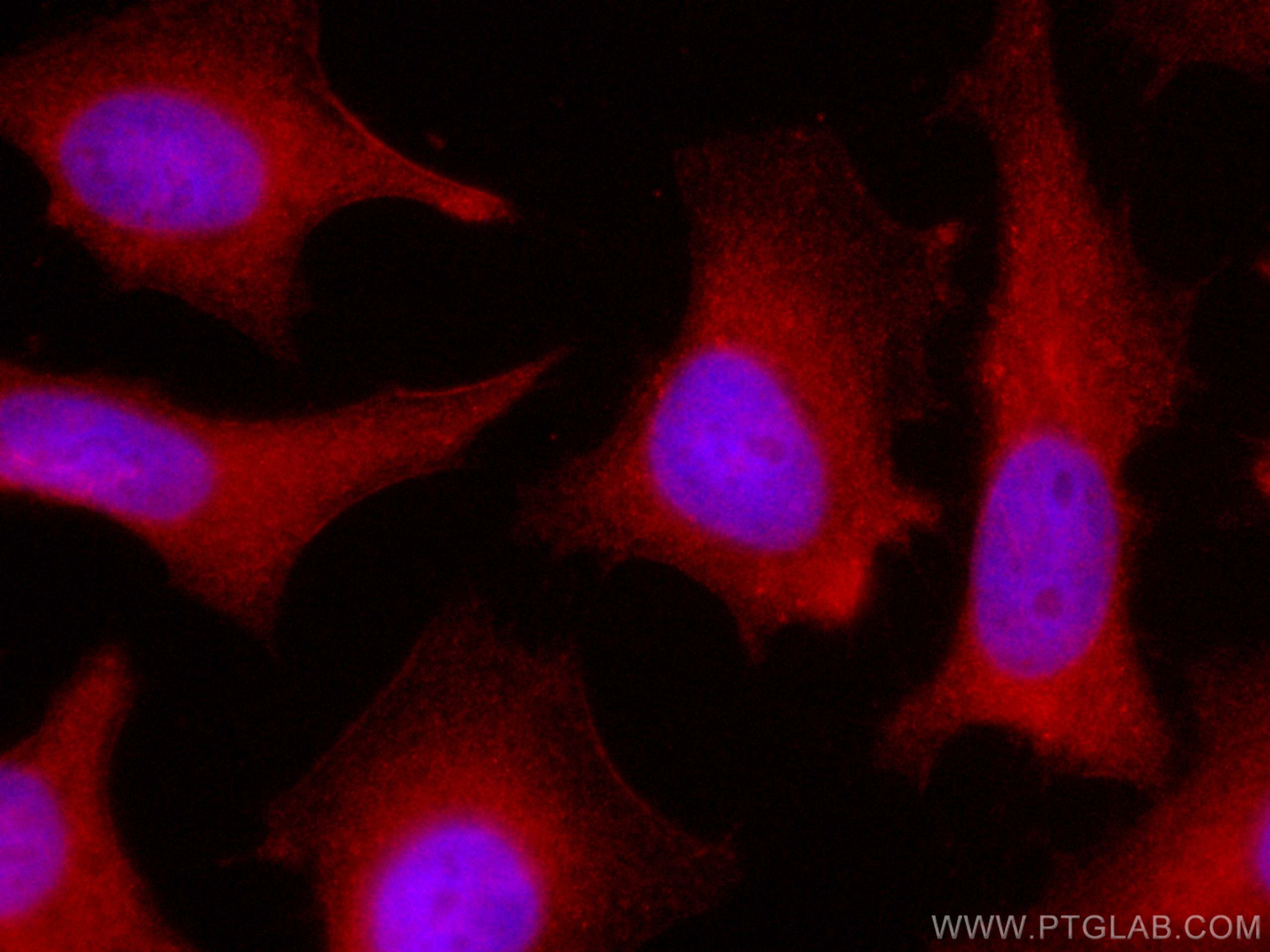 Immunofluorescence (IF) / fluorescent staining of HeLa cells using CoraLite®594-conjugated UBXD1 Polyclonal antibody (CL594-14706)